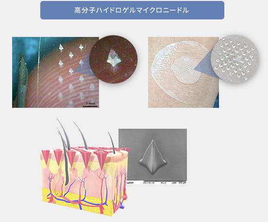 図15：高分子ハイドロゲルマイクロニードル