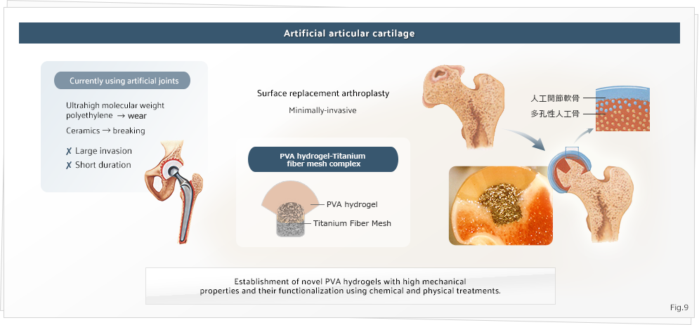 Artificial articular cartilage